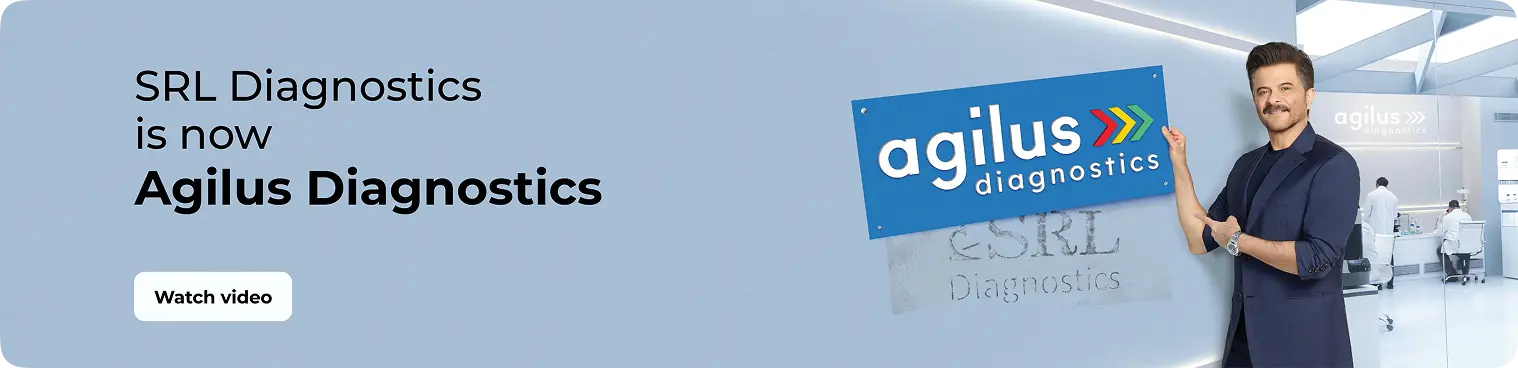 Agilus Diagnostics banner from the Vedant Diagnostics website